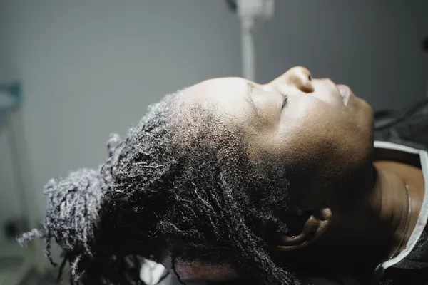 Trasplante Capilar Afro para Mujeres