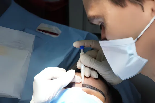 Trasplante de Cejas
