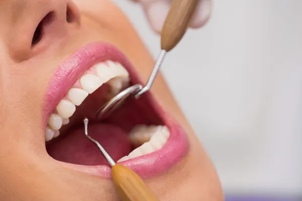 Tratamiento de Periodontología