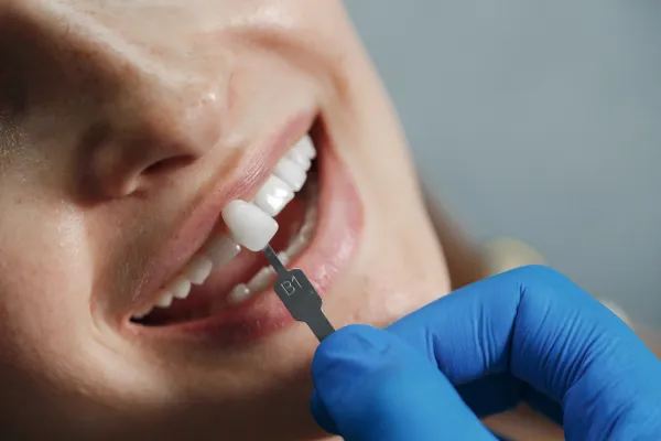 Recubrimiento de Zirconio